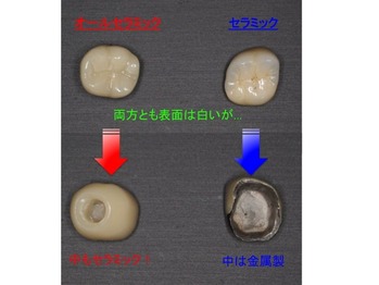 セラミックの比較